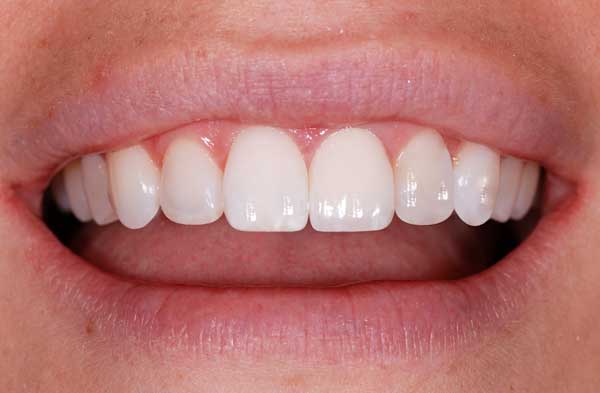 cosmetic-dentistry