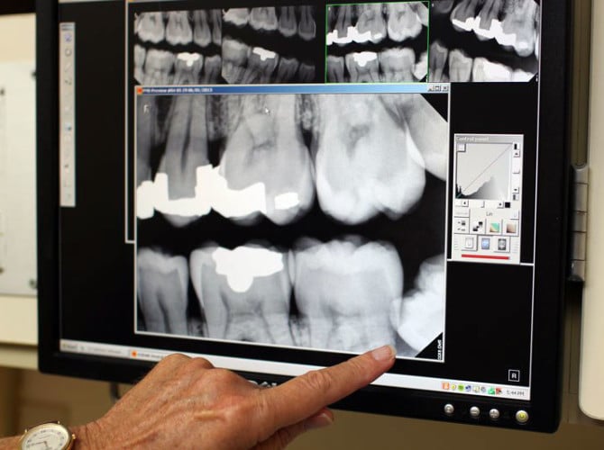 dentist_showing_xray